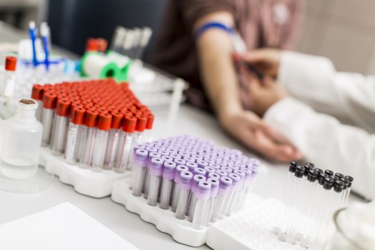 This is a picture of a lab room with blood tubes in groups on a table.